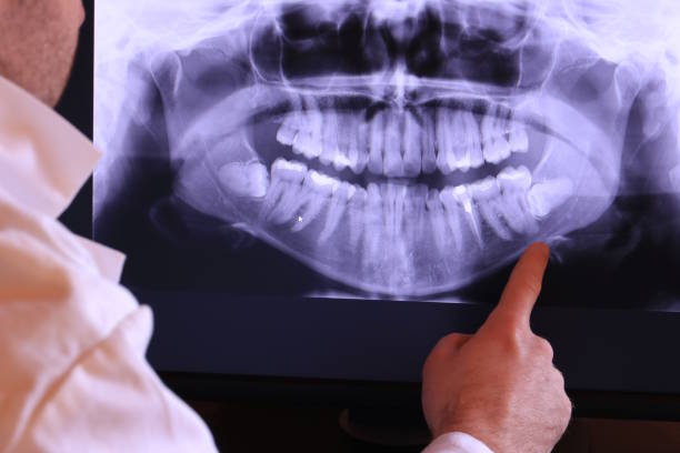 Best Pediatric Emergency Dentist in Lake Monticello, VA
